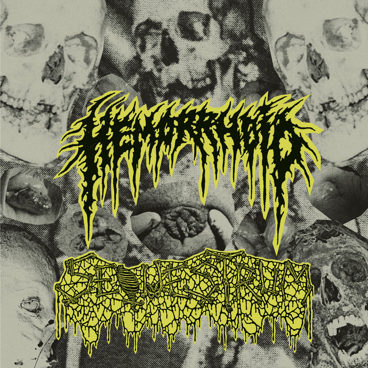 HEMORRHOID / SEQUESTRUM - Split 7"