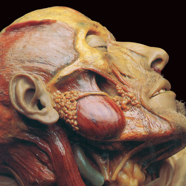 Lymphatic Phlegm - "Show-off Cadavers – The Anatomy of Self Display" LP