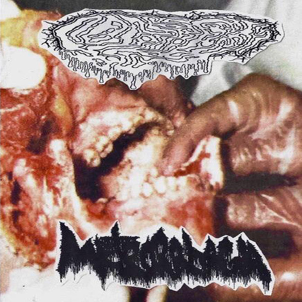 Metrorrhagia / Fetal Deformity split 7"