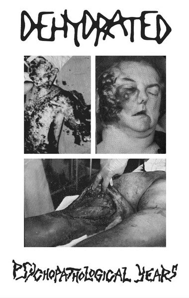 DEHYDRATED - Psychopathological Years MC