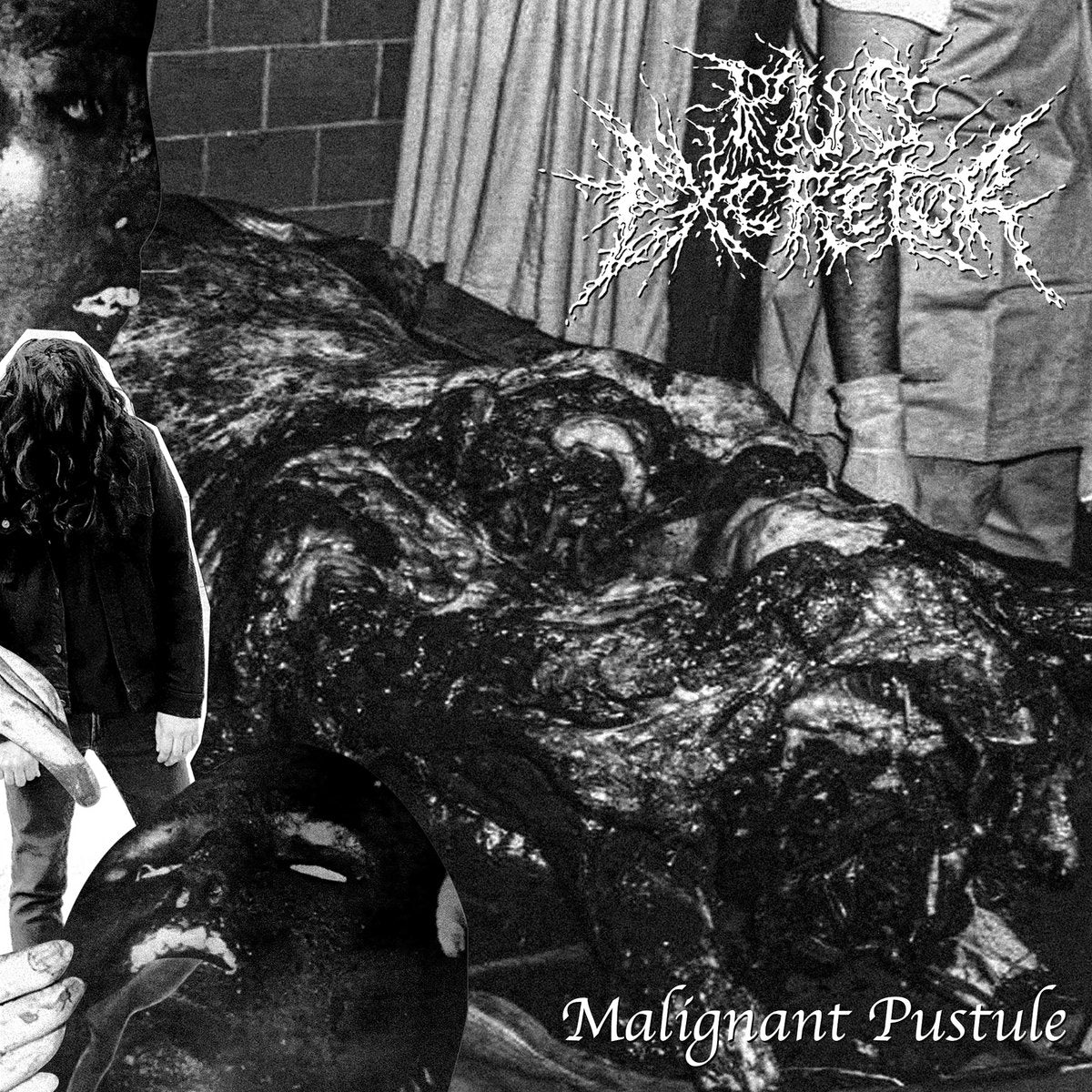 PUS EXCRETOR – Malignant Pustule 7”
