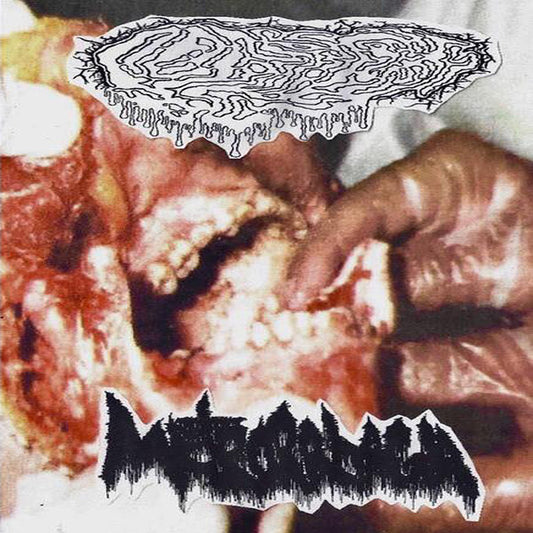 Metrorrhagia / Fetal Deformity split 7"